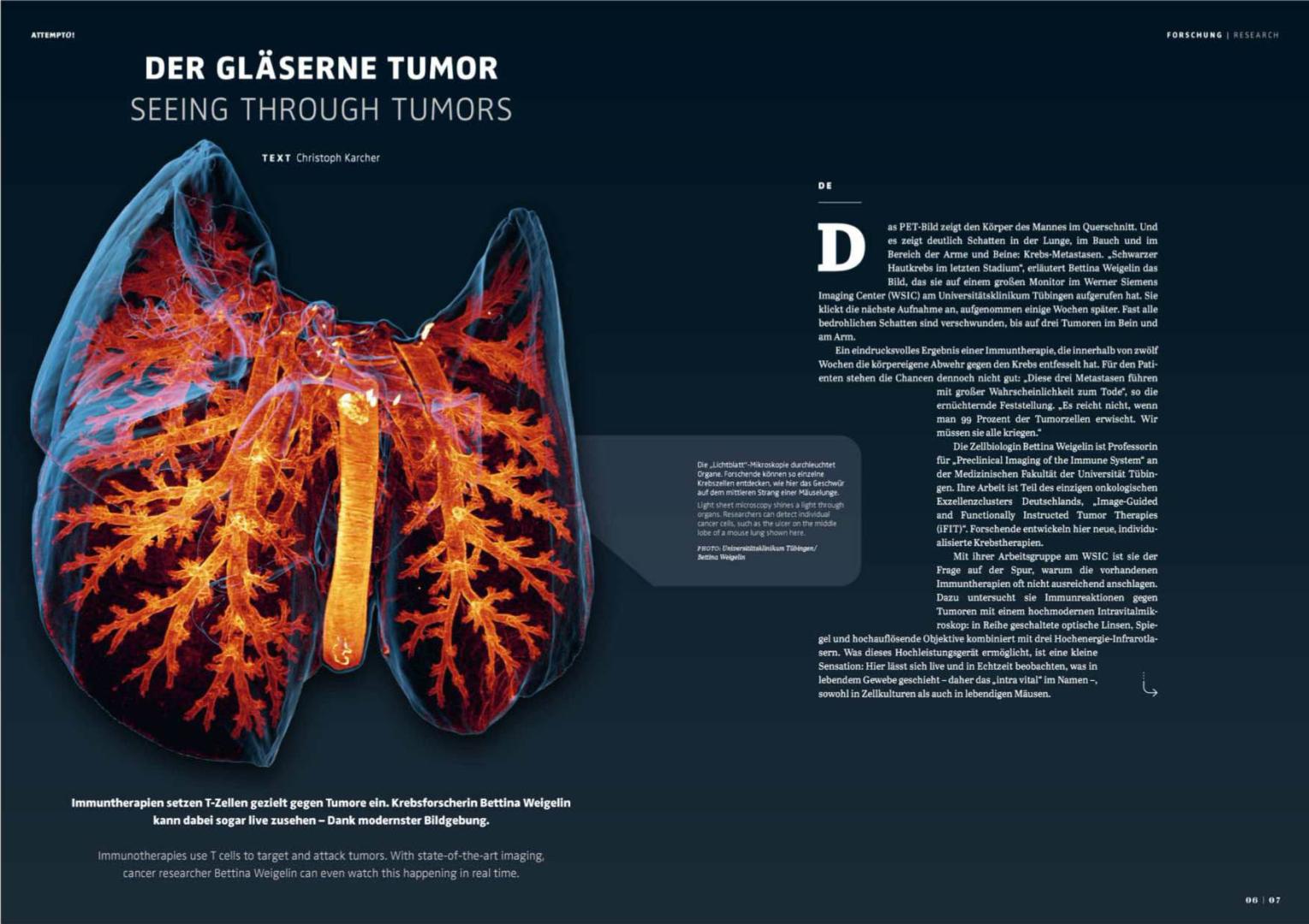 Der gläserne Tumor Christoph Karcher Artikel in Forschungsmagazin attempto! Universität Tübingen